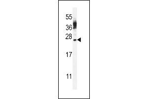 CT45A Antibody (Center) (ABIN656065 and ABIN2850490) western blot analysis in WiDr cell line lysates (35 μg/lane). (CT45A4/CT45A3/CT45A2/CT45A1/CT45A6 (AA 106-135) antibody)