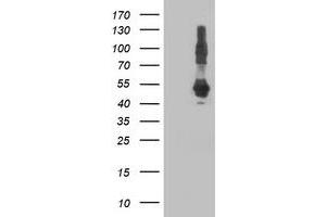HEK293T cells were transfected with the pCMV6-ENTRY control (Left lane) or pCMV6-ENTRY DNAJA2 (Right lane) cDNA for 48 hrs and lysed. (DNAJA2 antibody)