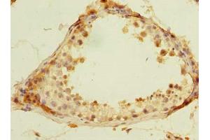 Immunohistochemistry of paraffin-embedded human testis tissue using ABIN7168420 at dilution of 1:100 (ROPN1L antibody  (AA 1-230))