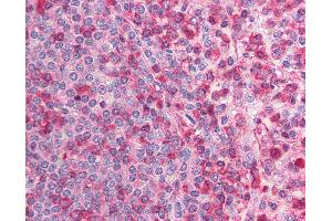 Anti-CACNB2 antibody IHC of human spleen. (CACNB2 antibody  (N-Term))