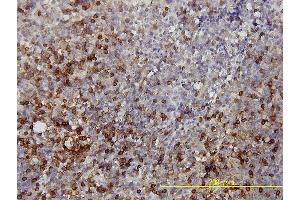 Immunoperoxidase of monoclonal antibody to LDHB on formalin-fixed paraffin-embedded human tonsil tissue. (LDHB antibody  (AA 1-334))