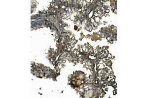 IHC analysis of IFT88 using anti-IFT88 antibody (ABIN7600458). (IFT88 antibody  (AA 198-814))