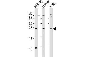All lanes : Anti-SOST Antibody (N-term) at 1:2000 dilution Lane 1: mouse lung lysates Lane 2: human liver lysates Lane 3: Hela whole cell lysates Lysates/proteins at 20 μg per lane. (Sclerostin antibody  (N-Term))