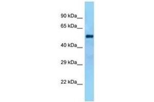 Image no. 1 for anti-Galactose 3-O-Sulfotransferase 4 (GAL3ST4) (AA 130-179) antibody (ABIN6748340) (GAL3ST4 antibody  (AA 130-179))