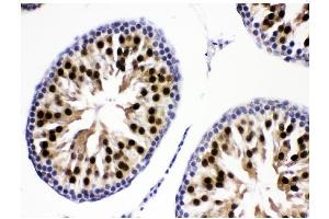 IHC analysis of KDM5B using anti-KDM5B antibody (ABIN4886648). (KDM5B antibody  (Middle Region))