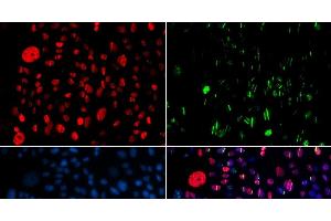 Immunofluorescence analysis of GFP-RNF168 transgenic U2OS cells using Phospho-SMC1A(S957) Polyclonal Antibody (SMC1A antibody  (pSer957))
