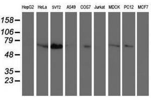 Image no. 1 for anti-Schwannomin Interacting Protein 1 (SCHIP1) antibody (ABIN1500823) (SCHIP1 antibody)