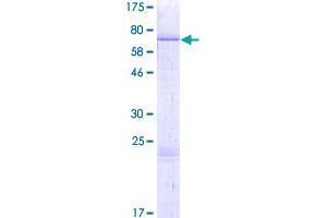 Image no. 1 for Transmembrane Protease, serine 11B (TMPRSS11B) (AA 1-416) protein (GST tag) (ABIN1323085) (TMPRSS11B Protein (AA 1-416) (GST tag))