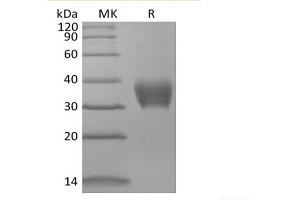 BTN3A2 Protein (His tag)