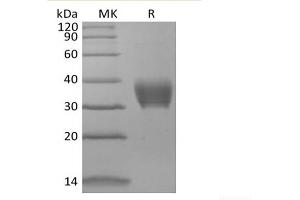 Western Blotting (WB) image for Butyrophilin, Subfamily 3, Member A2 (BTN3A2) protein (His tag) (ABIN7320925) (BTN3A2 Protein (His tag))