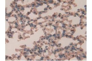 IHC-P analysis of Mouse Lung Tissue, with DAB staining. (Retinoic Acid Receptor alpha antibody  (AA 237-459))
