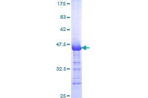 Image no. 1 for Latent Transforming Growth Factor beta Binding Protein 2 (LTBP2) (AA 1709-1818) protein (GST tag) (ABIN1309874) (LTBP2 Protein (AA 1709-1818) (GST tag))