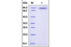 Human IL-2 R gamma, Fc Tag on SDS-PAGE under reducing (R) condition. (IL2RG Protein (AA 23-254) (Fc Tag))