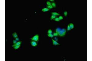 Immunofluorescent analysis of PC-3 cells using ABIN7143174 at dilution of 1:100 and Alexa Fluor 488-congugated AffiniPure Goat Anti-Rabbit IgG(H+L) (ACVR1 antibody  (AA 20-125))