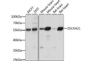 Western blot analysis of extracts of various cell lines, using ZSC antibody (ABIN7271444) at 1:1000 dilution. (ZSCAN21 antibody  (AA 130-280))