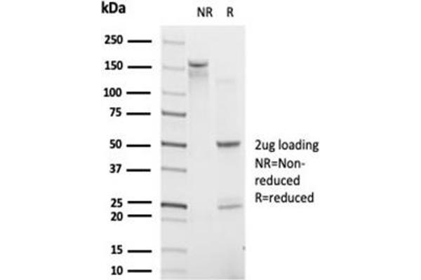 IRF9 antibody