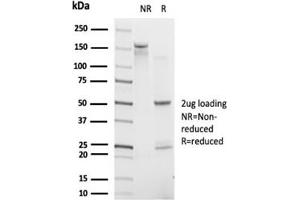 SDS-PAGE Analysis. (IRF9 antibody)