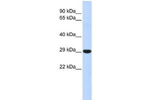 WB Suggested Anti-HOXB8 Antibody Titration: 0. (HOXB8 antibody  (N-Term))