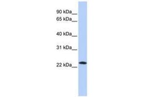Image no. 1 for anti-Stromal Cell Derived Factor 2 (SDF2) (C-Term) antibody (ABIN6741043) (SDF2 antibody  (C-Term))