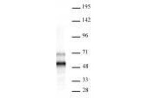 MEIS 1/2/3 antibody (rAb) tested by Western blot. (Recombinant MEIS1/MEIS2/MEIS3 (AA 59-390) antibody)