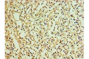 Immunohistochemistry of paraffin-embedded human spleen tissue using ABIN7151129 at dilution of 1:100 (RNF125 antibody  (AA 1-232))