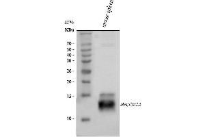 Western blot analysis of PF4 using anti-PF4 antibody (ABIN4886693). (PF4 antibody  (AA 30-105))