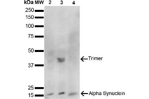 Western Blot analysis of Human, Mouse, Rat Brain showing detection of 14 kDa Alpha Synuclein protein using Mouse Anti-Alpha Synuclein Monoclonal Antibody, Clone 10H7 (ABIN5564071). (SNCA antibody)