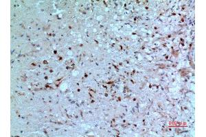 Immunohistochemistry (IHC) analysis of paraffin-embedded Human Brain, antibody was diluted at 1:100. (Thymidine Phosphorylase antibody  (N-Term))