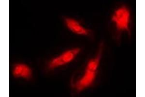 Immunofluorescent analysis of p35 staining in HeLa cells.