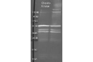 Goat anti Glycerol Kinase antibody  was used to detect purified Glycerol Kinase under reducing (R) and non-reducing (NR) conditions. (Glycerol Kinase antibody)