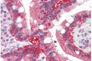 Human Small Intestine (formalin-fixed, paraffin-embedded) stained with AKR1C3 antibody ABIN343889 at 5 ug/ml followed by biotinylated anti-goat IgG secondary antibody ABIN481715, alkaline phosphatase-streptavidin and chromogen. (AKR1C3 antibody  (AA 311-323))