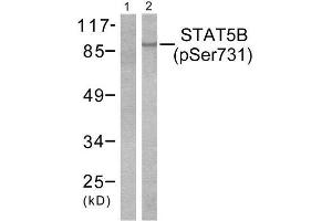 Western Blotting (WB) image for anti-Signal Transducer and Activator of Transcription 5B (STAT5B) (pSer731) antibody (ABIN1847251) (STAT5B antibody  (pSer731))