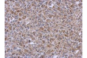 IHC-P Image Immunohistochemical analysis of paraffin-embedded RT2 xenograft, using DLST, antibody at 1:500 dilution. (DLST antibody  (Center))