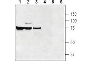 Western blot analysis of rat kidney (lanes 1 and 4), mouse brain (lanes 2 and 5) and rat testis (lanes 3 and 6): - 1-3. (SLC47A1 antibody  (5th Cytoplasmic Loop))