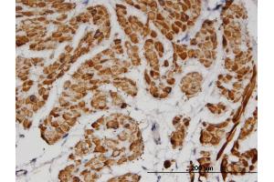 Immunoperoxidase of monoclonal antibody to TPM2 on formalin-fixed paraffin-embedded human smooth muscle. (TPM2 antibody  (AA 1-284))