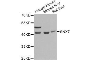 Western blot analysis of extracts of various cell lines, using SNX7 Antibody. (Sorting Nexin 7 antibody)