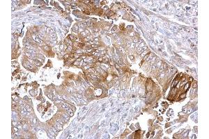 Immunohistochemistry (IHC) image for anti-Fatty Acid Synthase (FASN) (N-Term) antibody (ABIN2856708)