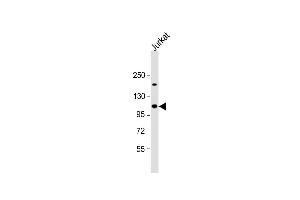 Anti-UBL Antibody (Center) at 1:1000 dilution + Jurkat whole cell lysate Lysates/proteins at 20 μg per lane. (UBAP2L antibody  (AA 575-601))