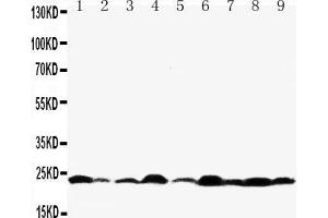 Western blot analysis of Bax using anti- Bax antibody . (BAX antibody  (N-Term))