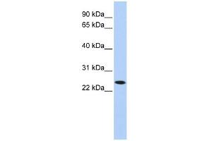 KLRA1 antibody used at 1 ug/ml to detect target protein. (KLRA1 antibody  (N-Term))