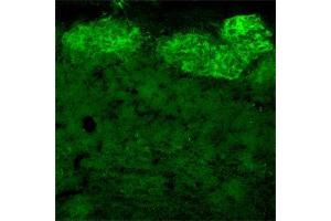 Immunofluorescence (IF) image for anti-Nerve Growth Factor Receptor (NGFR) antibody (ABIN350707)