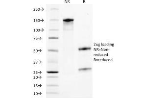 SDS-PAGE Analysis Purified TACSTD2-Monospecific Mouse Monoclonal Antibody (TACSTD2/2153).