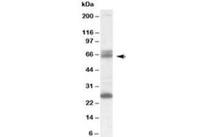 Western blot testing of human brain lysate with GAD65 antibody at 0. (GAD65 antibody)