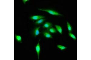 Immunofluorescence staining of Hela cells with ABIN7174567 at 1:400, counter-stained with DAPI. (ATG3 antibody  (AA 1-314))
