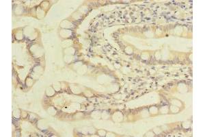 Immunohistochemistry of paraffin-embedded human small intestine tissue using ABIN7162550 at dilution of 1:100 (ZDHHC3 antibody  (AA 94-171))