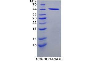 SDS-PAGE (SDS) image for Chemokine (C-C Motif) Ligand 21 (CCL21) (AA 5-132) protein (His tag,GST tag) (ABIN2123582)