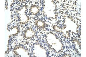 Rabbit Anti-RBM26 antibody   Paraffin Embedded Tissue: Human Lung cell Cellular Data: alveolar cell of renal tubule Antibody Concentration: 4. (RBM26 antibody  (Middle Region))