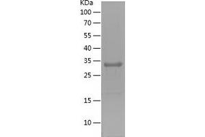 Western Blotting (WB) image for Zinc Finger Protein 306 (ZKSCAN3) (AA 1-248) protein (His tag) (ABIN7282835) (ZKSCAN3 Protein (AA 1-248) (His tag))