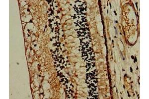 Immunohistochemistry of paraffin-embedded human eye tissue using ABIN7159316 at dilution of 1:100