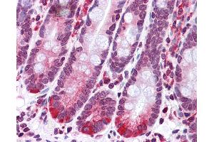 SCARA5 antibody  (C-Term)